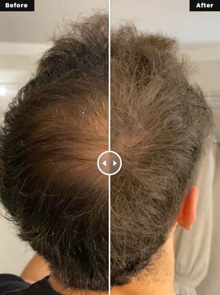 Roots Powder™